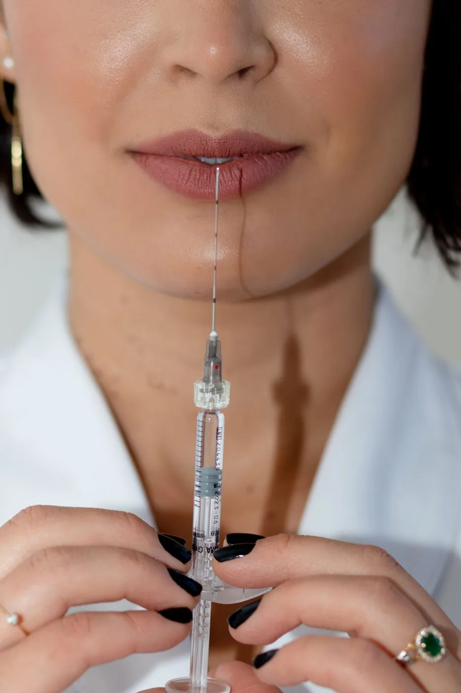 Lippen aufspritzen mit Hyaluron – präzise Injektion in Düsseldorf