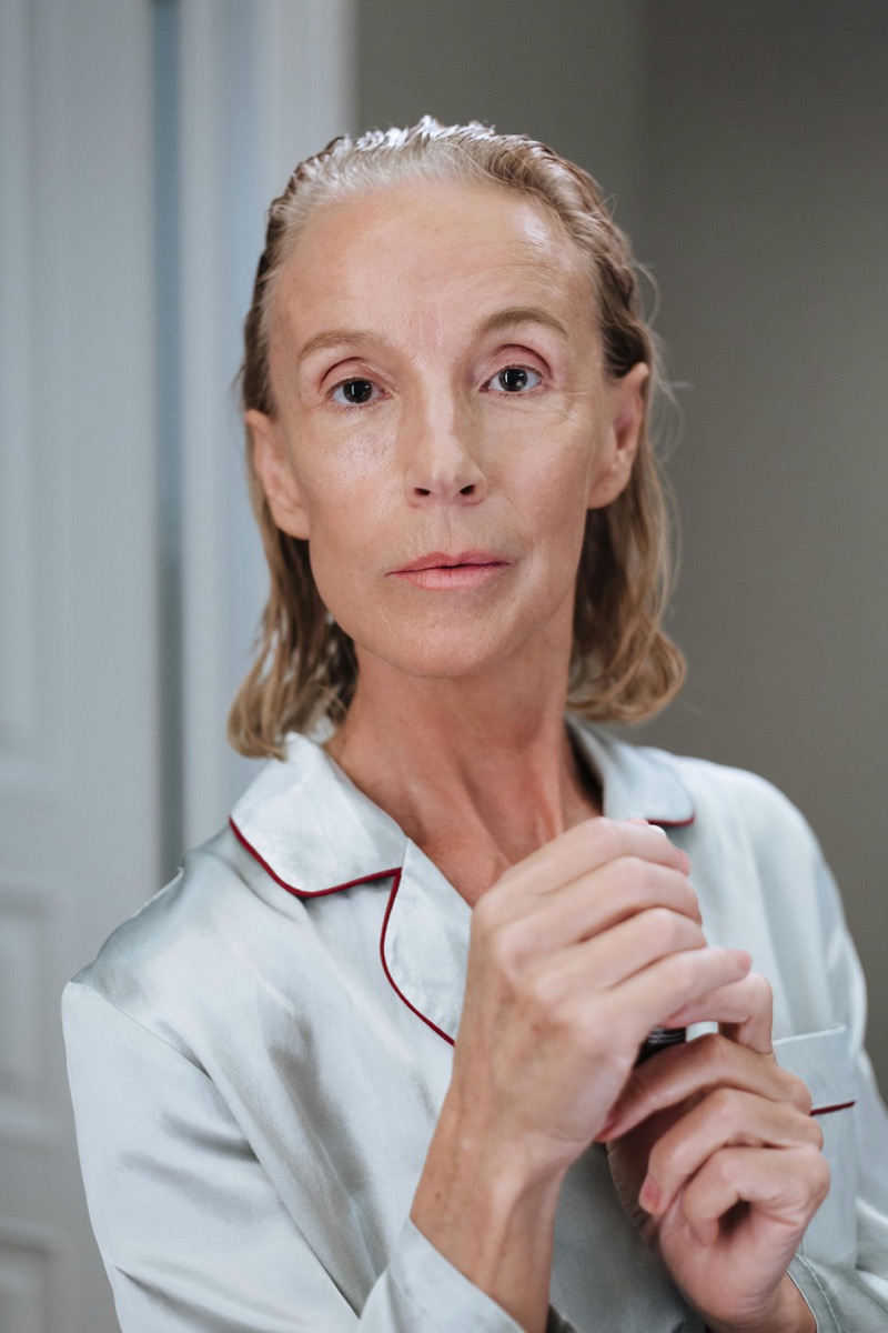 Botox Düsseldorf vorher — natürliche Mimikfalten Stirn und Krähenfüße, typische Indikation für Botulinumtoxin-Behandlung bei Dr. Fetai