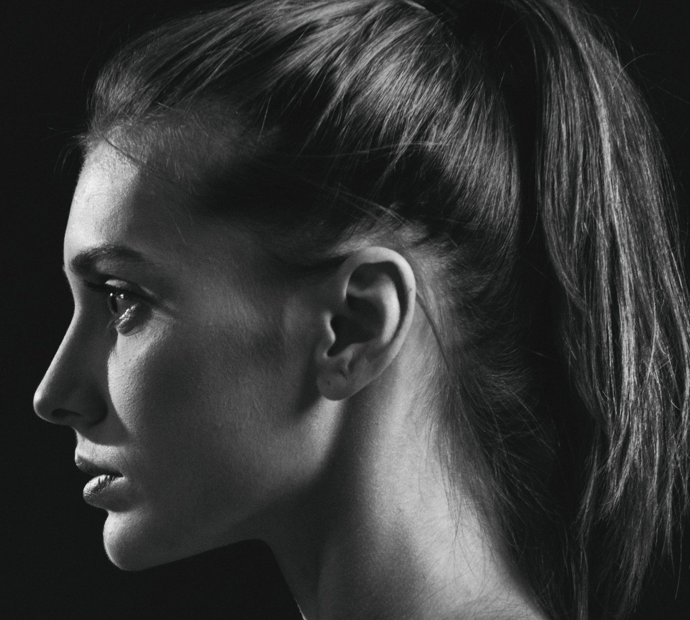 Klare Jawline-Kontur im Profil – Ergebnis nach Doppelkinn-Absaugung