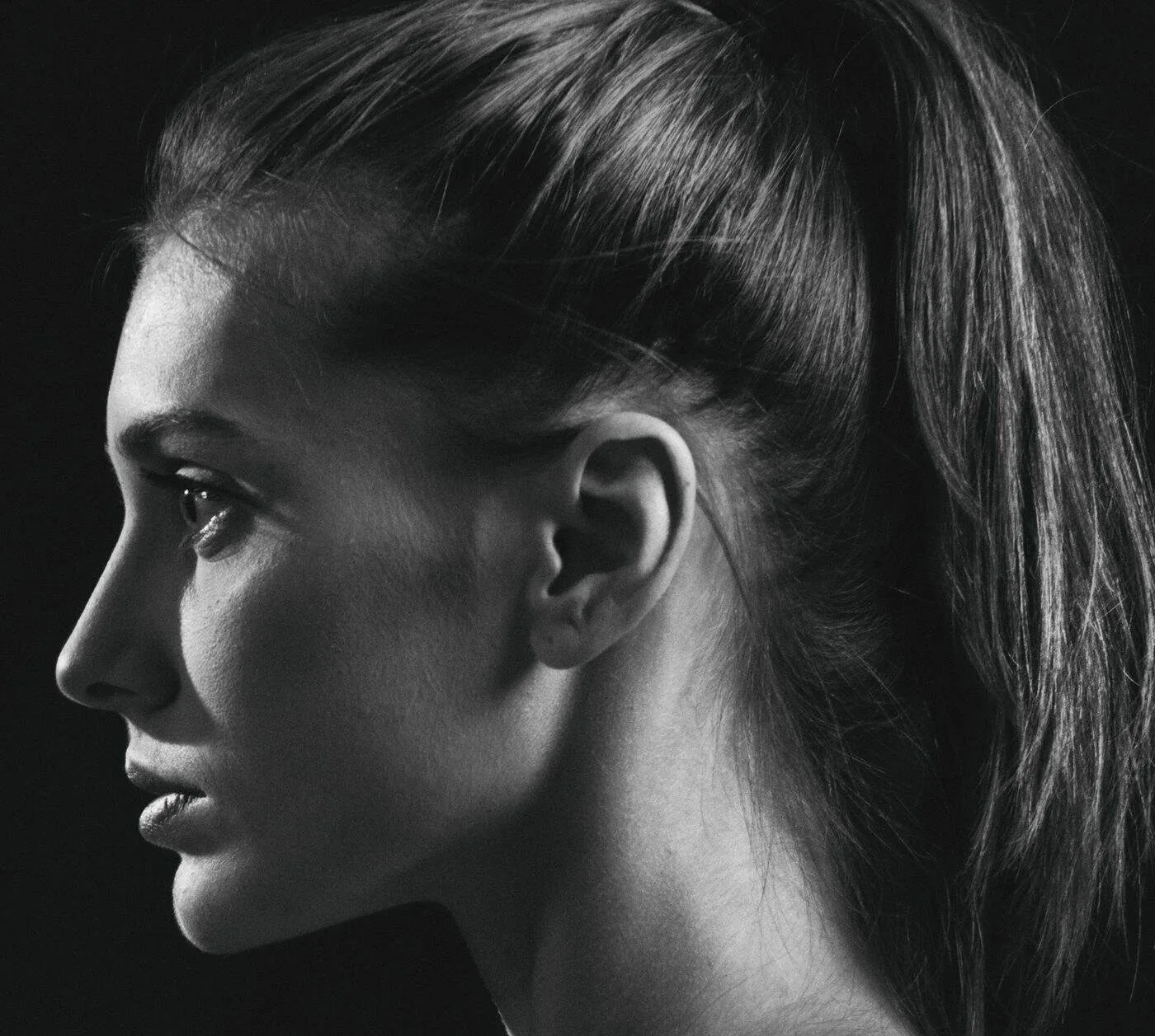 Klare Jawline-Kontur im Profil – Ergebnis nach Doppelkinn-Absaugung
