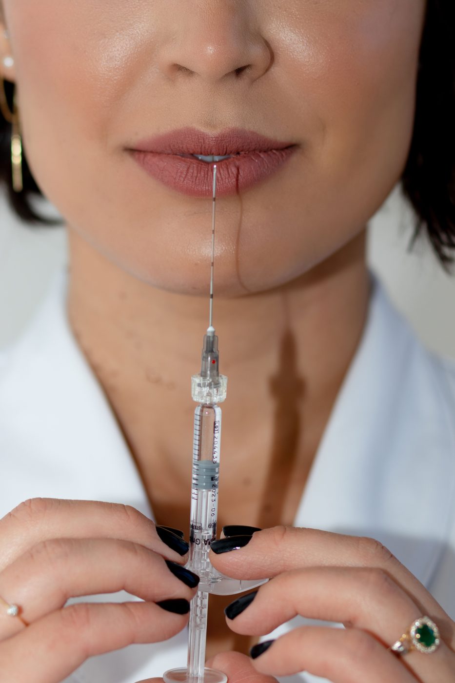 Lippen aufspritzen mit Hyaluron – präzise Injektion in Düsseldorf