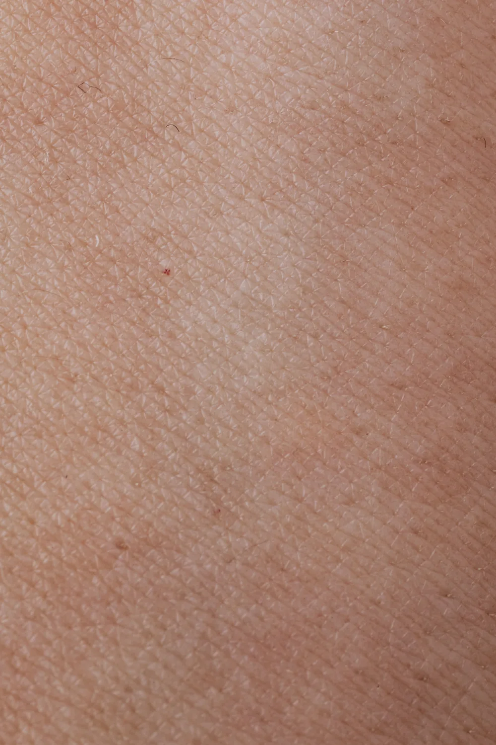 Wartebereich Body Art Surgery Institute Düsseldorf — Sculptra beim Facharzt Dr. (Univ. Te.) Nusret Fetai